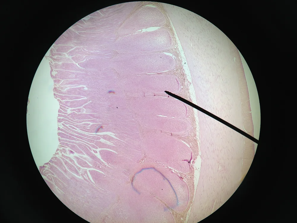Lymphatic System — See Why Anatomy